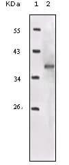 IGF1R / IGF1 Receptor Antibody (clone 3G5C1)