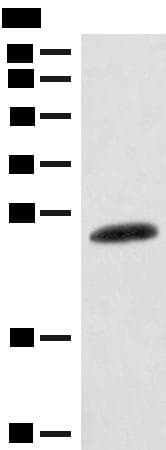 CSNK2B / Phosvitin Antibody