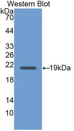 IFN Gamma / Interferon Gamma Antibody (aa24-167)