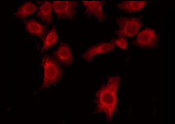 CYP-M / CYP20A1 Antibody