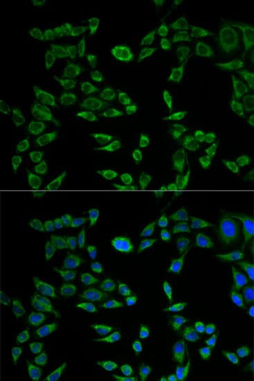 VAPB Antibody