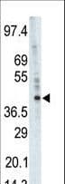 PHKG1 Antibody (aa302-332)