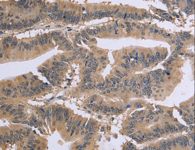 GSN / Gelsolin Antibody