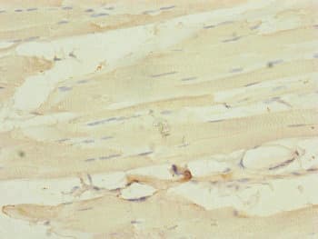 Polyclonal Rabbit anti-Human MLC3F / MYL1 Antibody (IHC)
