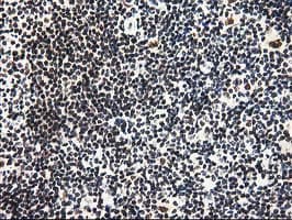 PYCRL Antibody (clone OTI8H6)