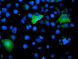TOMM34 Antibody (clone OTI1B6)