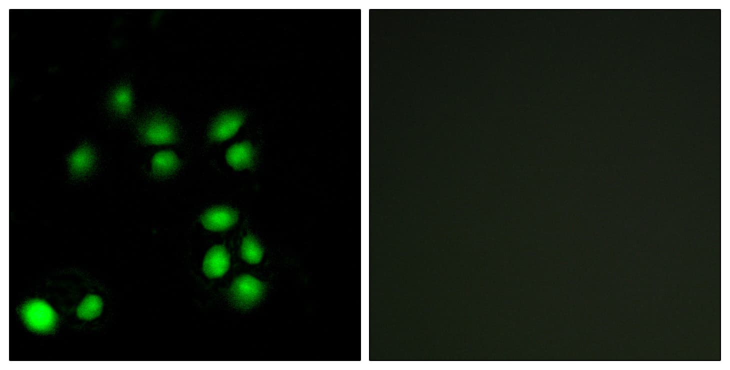 EXO1 Antibody (aa61-110)