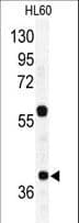 RAD23A / HHR23A Antibody (aa303-333)