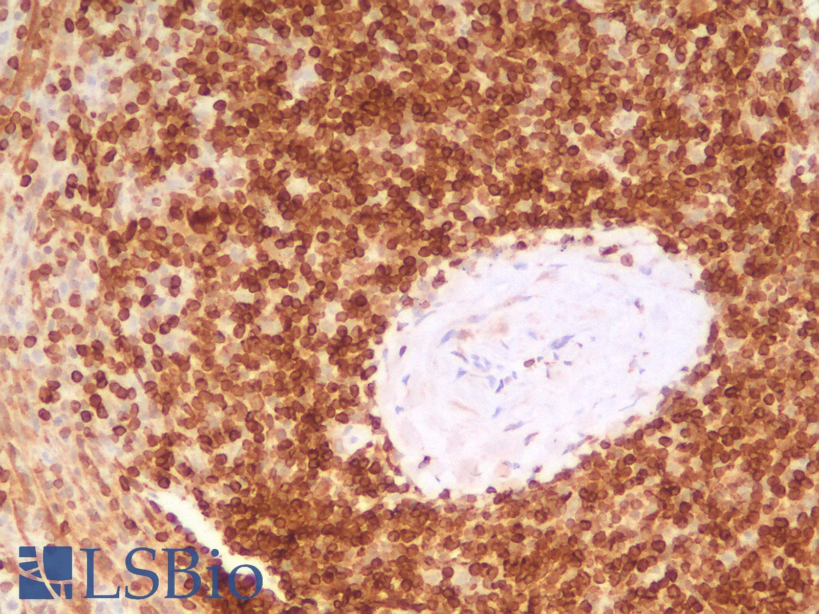 PathPlus™ BCL2 / Bcl-2 Antibody (clone rBCL2/782)