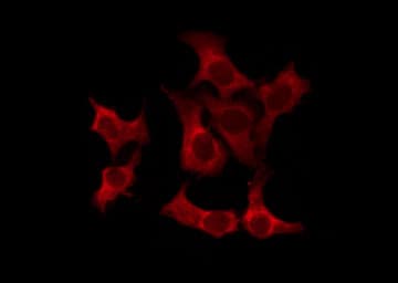 OR52N1 Antibody