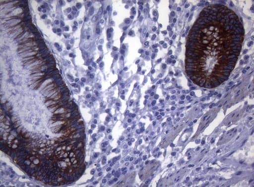 SYNC / SYNCOILIN Antibody (clone OTI5B8)
