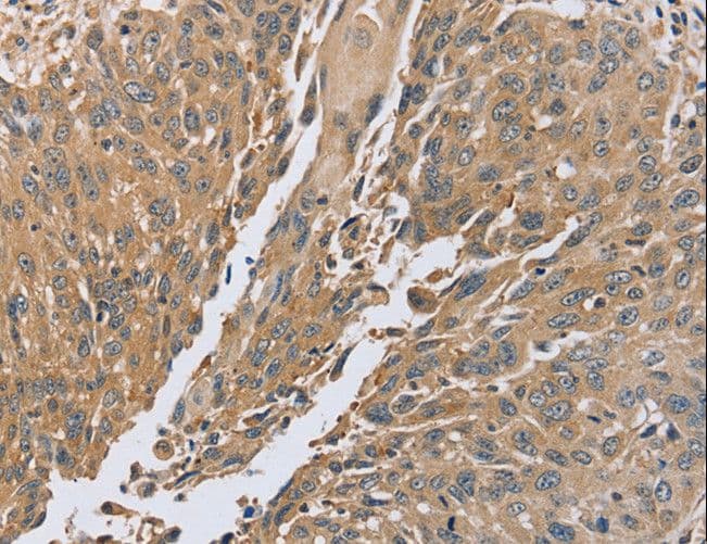 PTP-PEST / PTPN12 Antibody