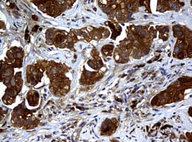NME1 / NM23 Antibody (clone OTI3F2, Carrier-free)
