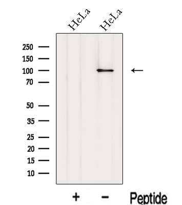 Polyclonal Rabbit anti-Human KPNB1 / Importin Beta Antibody (WB)