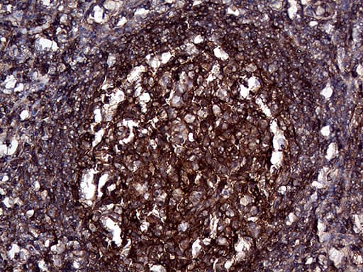GNAS Antibody (clone OTI13D7)