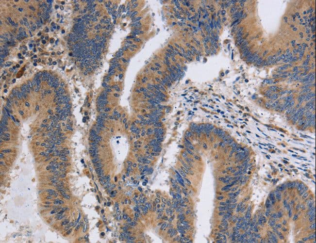 ITPR1 / IP3 Receptor Type 1 Antibody