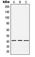 Polyclonal Rabbit anti-Human HCCS Antibody (Internal, IHC, IF, WB)