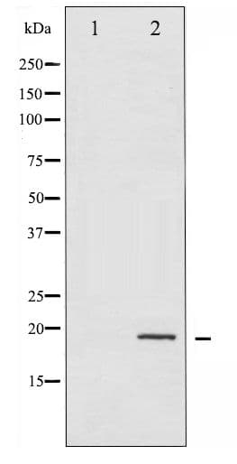 EIF4EBP1 / 4EBP1 Antibody (phospho-Thr36)