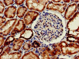 INSR / Insulin Receptor Antibody