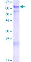Human PIAS1 Protein (Recombinant GST)