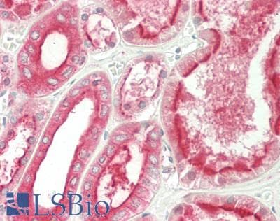 IHC-plus™ Monoclonal Mouse anti-Human ATP6V1B2 Antibody (clone 1E11, IHC, WB)