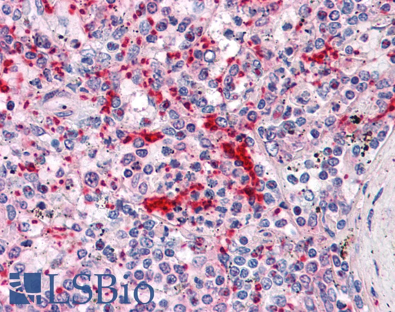 IHC-plus™ TLN1 / Talin 1 Antibody (clone 2E10)