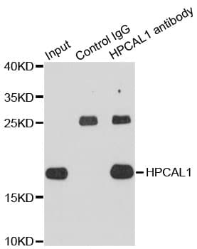 Polyclonal Rabbit anti-Human HPCAL1 / Hippocalcin-Like 1 Antibody (WB)