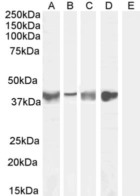 Polyclonal Goat anti-Human ASPN / Asporin Antibody (aa182-194, IF, WB)