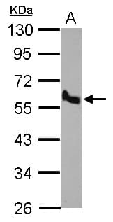 Polyclonal Rabbit anti-Human BMP10 Antibody (C-Terminus, IHC, WB)