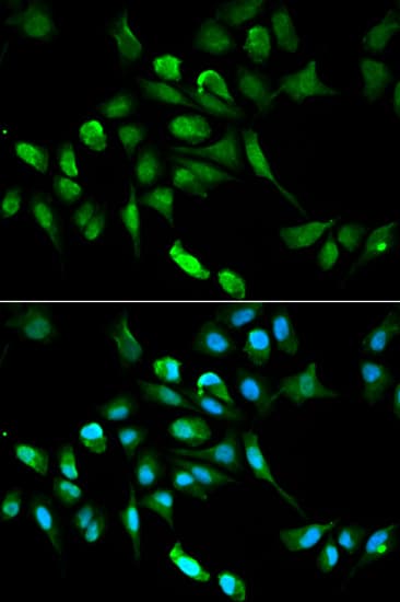 ADH5 Antibody
