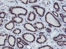 FXN / Frataxin Antibody (clone OTI1C12)