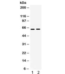 Polyclonal Rabbit anti-Human LOXL1 Antibody (IHC, WB)