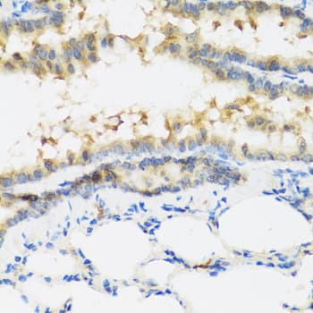 IL28B Antibody