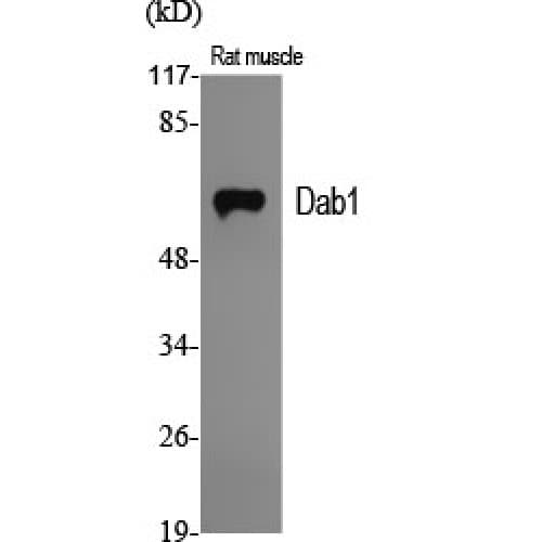 DAB1 Antibody (170-250 aa)