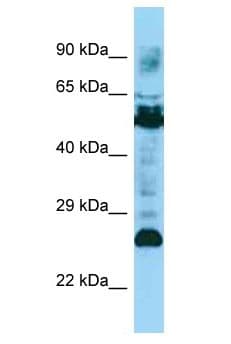 Polyclonal Rabbit anti-Human CD79A / CD79 Alpha Antibody (aa156-205, WB)