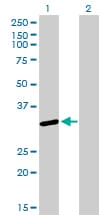 IHC-plus™ SNRPA / U1A Antibody (clone 3F9-1F7)