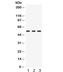Polyclonal Rabbit anti-Human HTR2A / 5-HT2A Receptor Antibody (WB)