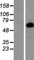 Human PRLR / Prolactin Receptor Protein (Over-Expression Lysate Myc-DDK (Flag))