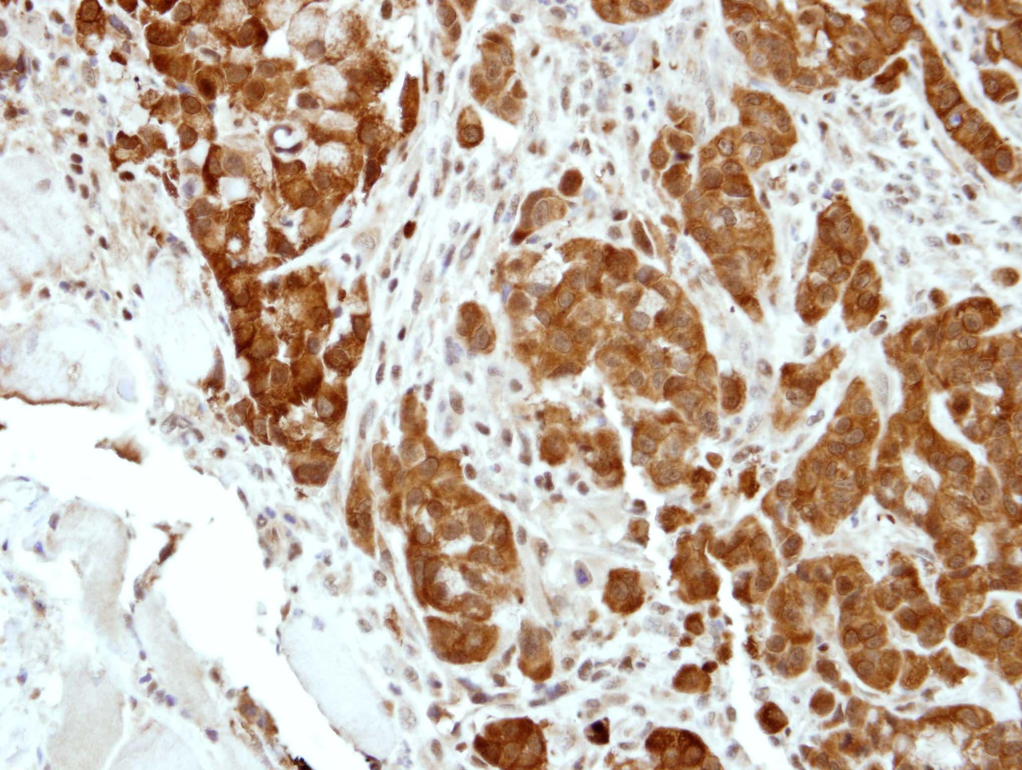 Polyclonal Rabbit anti-Human BCL2L15 Antibody (aa1-163, IHC, WB)