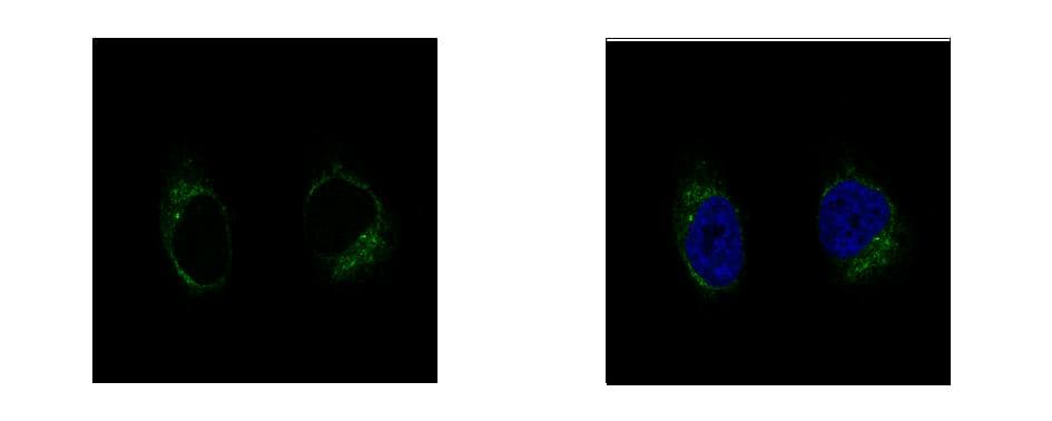 Polyclonal Rabbit anti-Human TUBGCP2 / GCP2 Antibody (aa1-226, IHC, WB)