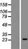 LAT Protein (Over-Expression Lysate Myc-DDK (Flag))