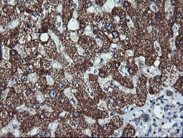 IHC-plus™ ACAA2 Antibody (clone 1C10)