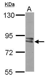 IHC-plus™ Polyclonal Rabbit anti-Human PFKM / PFK-1 Antibody (aa1-253, IHC, WB)