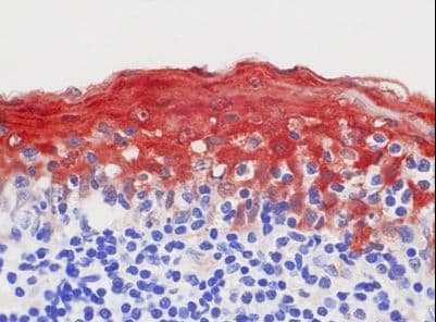 S100A8 / MRP8 Antibody (clone 8-5C2)