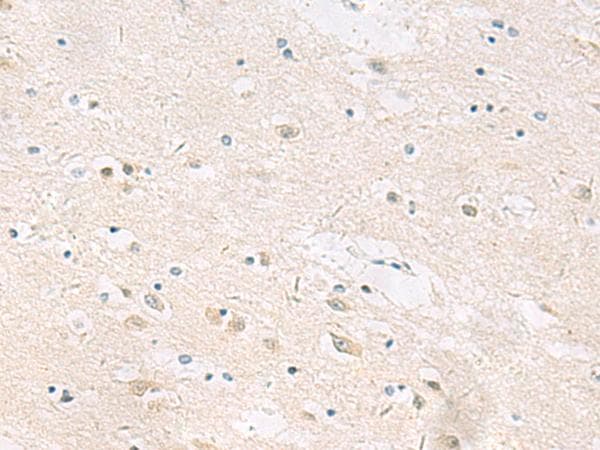 ANKS6 Antibody