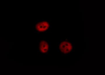 NFKB1 / NF-Kappa-B Antibody (phospho-Ser927)