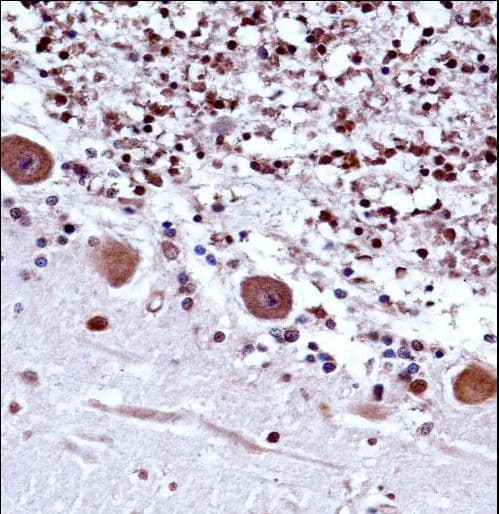 TRA2B / SFRS10 Antibody (aa208-237)