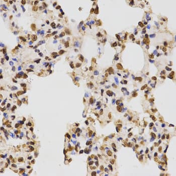 Histone H3 Antibody (Asym-Di-Methyl-Arg17)