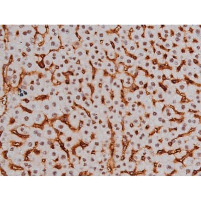 Polyclonal Rabbit anti-Human MAPT / Tau Antibody (phospho-Thr205, IHC, WB)