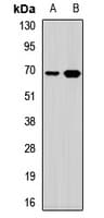 TRMT2A Antibody